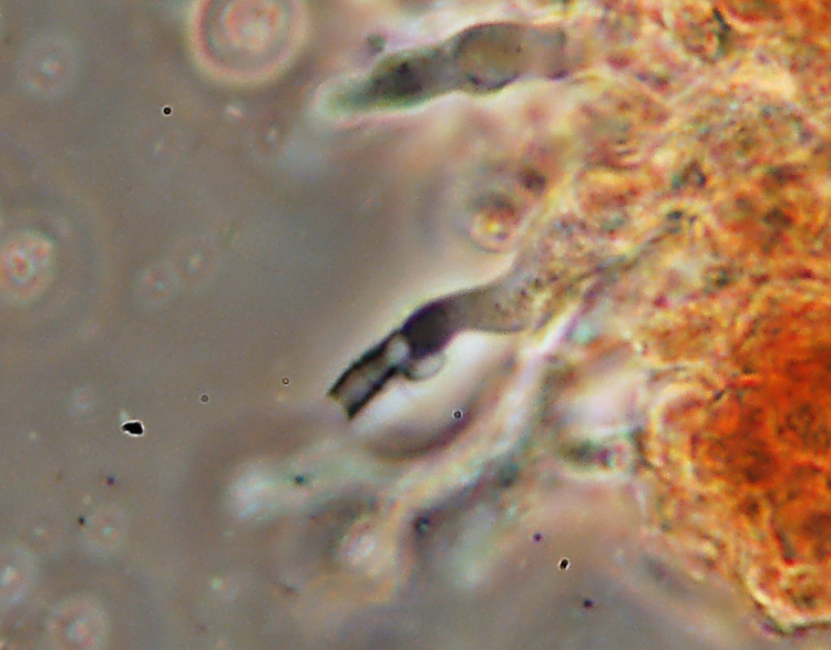 Vuilleminia megalospora Bres.